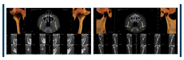 Cone Beam