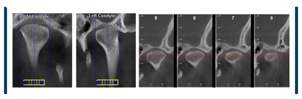 Cone Beam