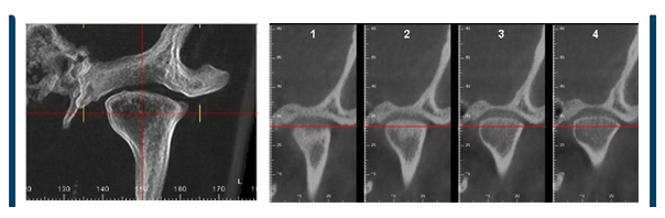 Cone Beam
