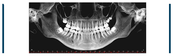 Cone Beam