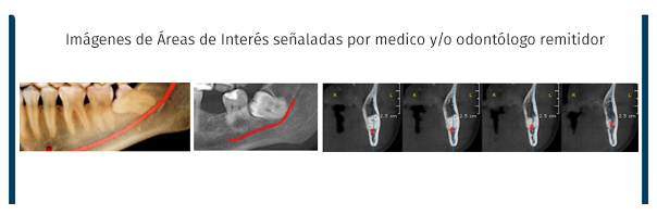 Cone Beam