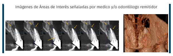 Cone Beam