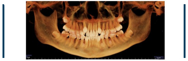 Cone Beam