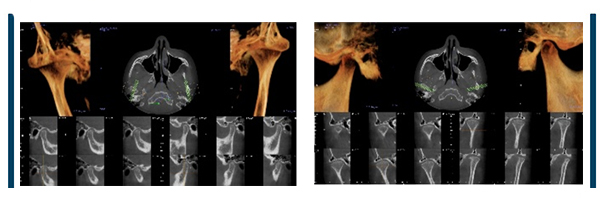 Cone Beam